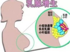 双阳鹿乡老刘家—乳腺增生结节怎么调理最好方